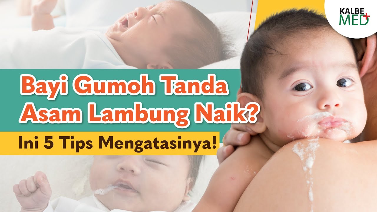 Gumoh Pada Bayi