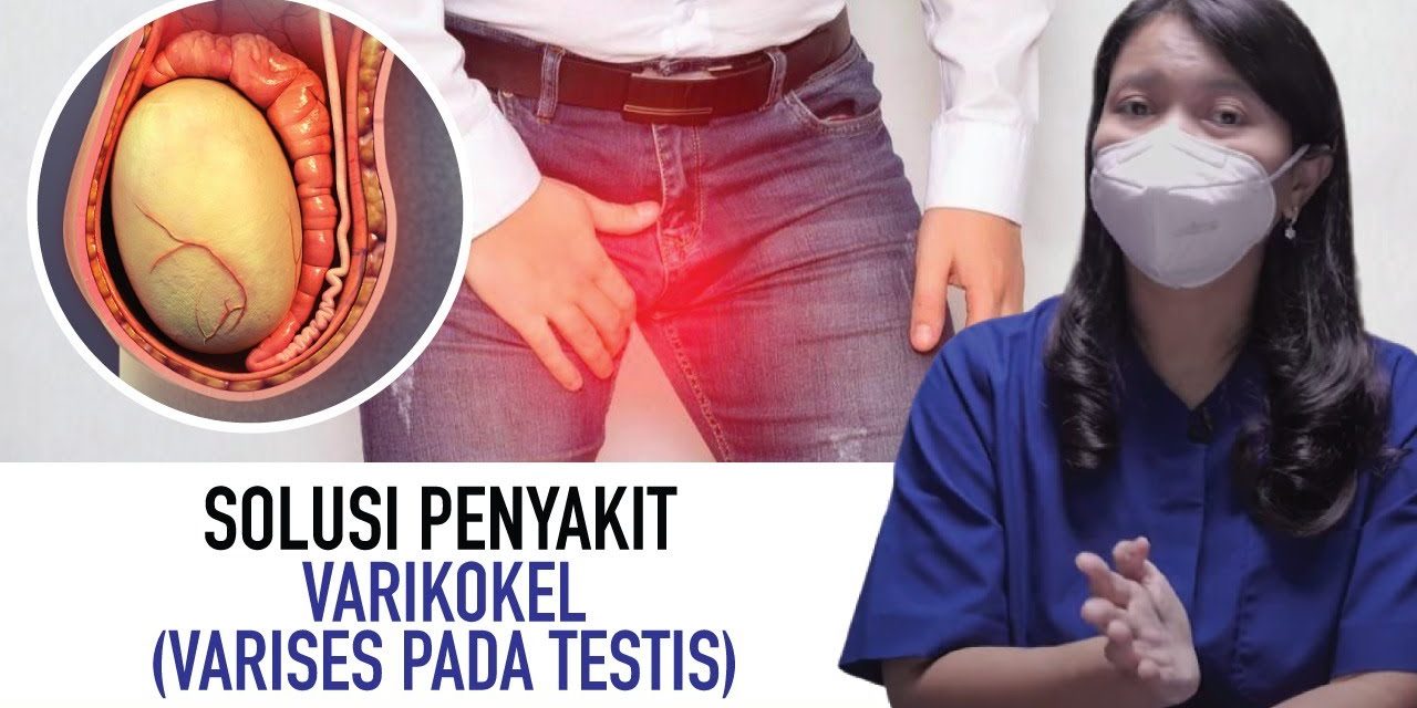 Penyakit Varikokel Cukup Berbahaya, Kenali Beberapa Gejalanya