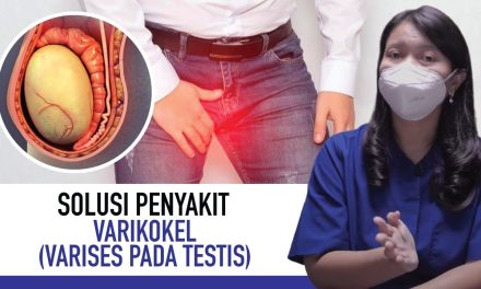 Penyakit Varikokel Cukup Berbahaya, Kenali Beberapa Gejalanya
