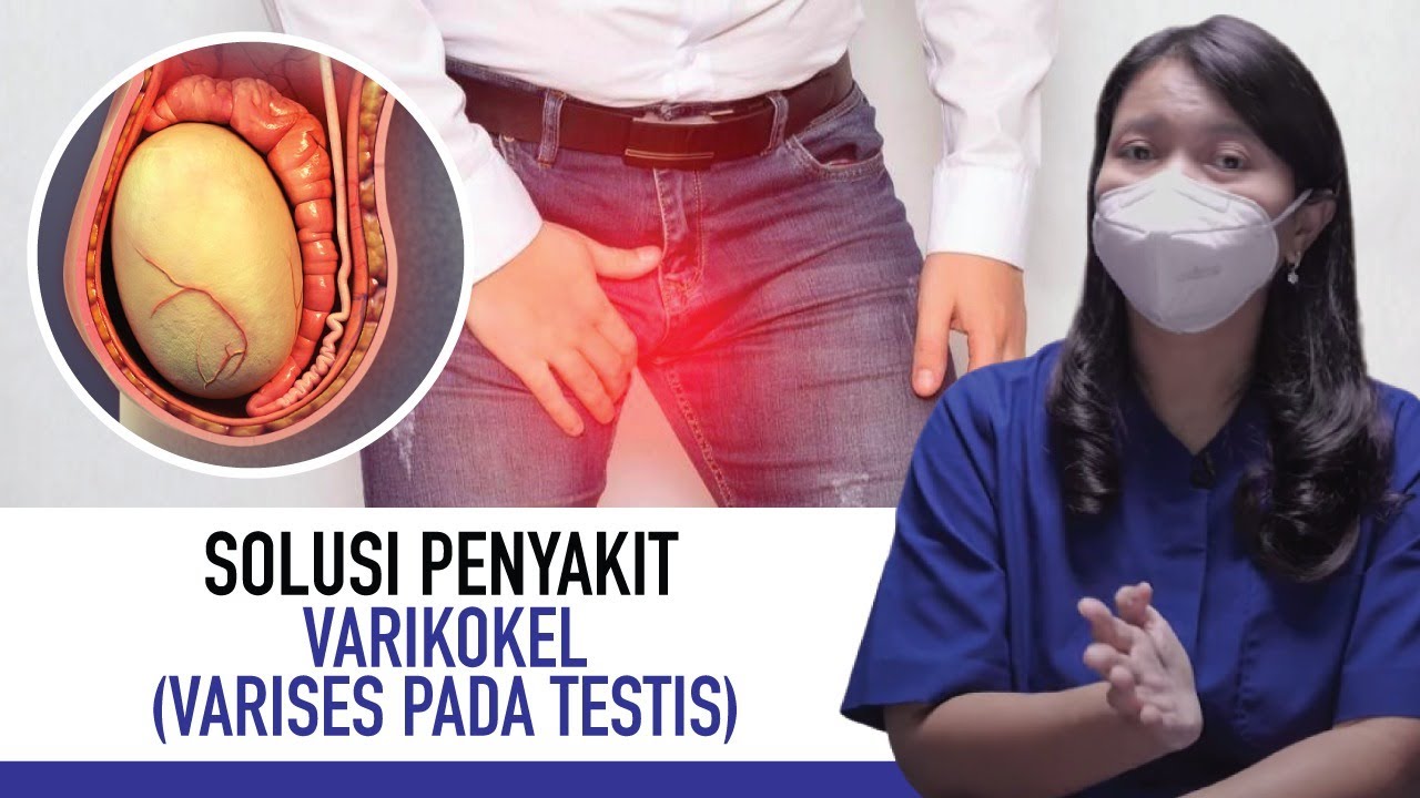 Penyakit Varikokel